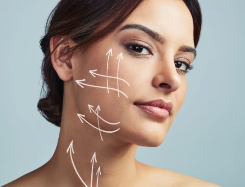 Non-Surgical Facelifts by Dr. Monica Michel – The Art of Facial Balancing